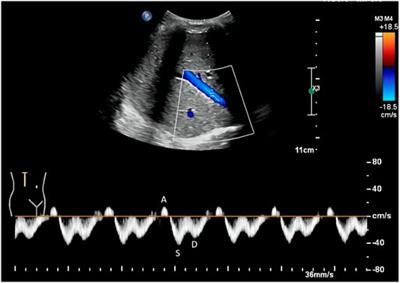 Frontiers Intrarenal Doppler Approaches In Hemodynamics A Major Application In Critical Care